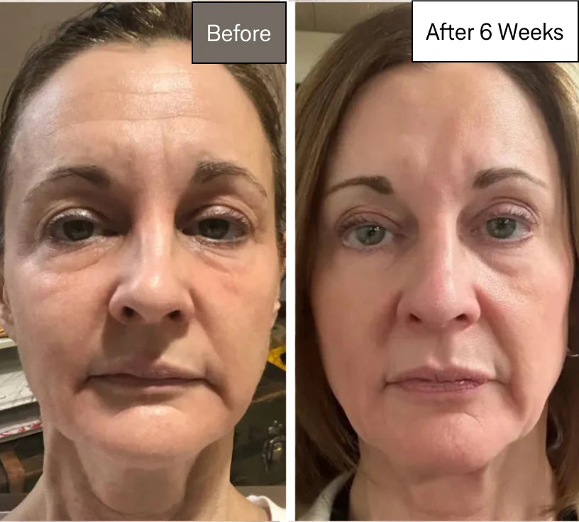 Omnilux Contour Face Mask