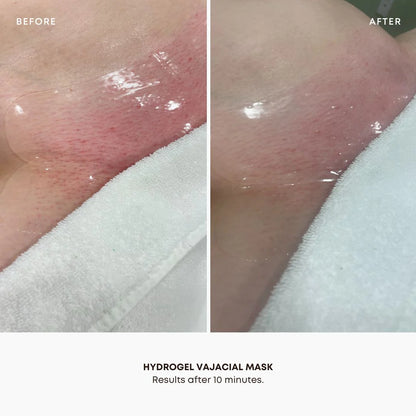 BushBalm Hydrogel Vajacial Mask